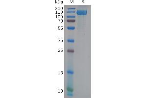 Human ANPEP Protein, His Tag on SDS-PAGE under reducing condition.