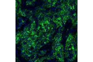 Immunofluorescence (IF) image for anti-CD274 (PD-L1) (C-Term) antibody (ABIN7454042) (Rekombinanter PD-L1 Antikörper  (C-Term))