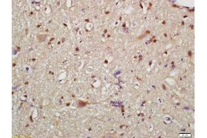 Formalin-fixed and paraffin embedded mouse brain labeled with Rabbit Anti-HMGCR(Ser872) Polyclonal Antibody, Unconjugated  at 1:200 followed by conjugation to the secondary antibody and DAB staining