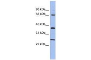 Image no. 1 for anti-HORMA Domain Containing 2 (HORMAD2) (AA 107-156) antibody (ABIN6743696) (HORMAD2 Antikörper  (AA 107-156))