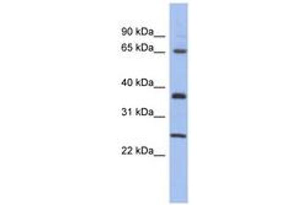 HORMAD2 Antikörper  (AA 107-156)