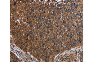 Immunohistochemistry of Human brain  using FCGR3A Polyclonal Antibody at dilution of 1:60 (FCGR3A Antikörper)