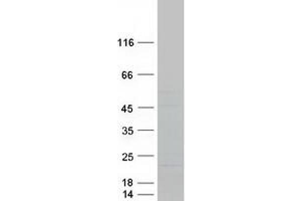 ORMDL3 Protein (Myc-DYKDDDDK Tag)