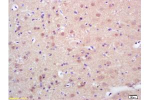 Formalin-fixed and paraffin embedded rat brain labeled with Rabbit Anti phospho-HSF1(Ser326) Polyclonal Antibody, Unconjugated (ABIN703466) at 1:200 followed by conjugation to the secondary antibody and DAB staining (HSF1 Antikörper  (pSer326))