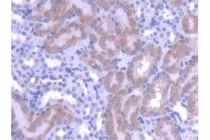 Detection of MTF1 in Mouse Kidney Tissue using Polyclonal Antibody to Metal Regulatory Transcription Factor 1 (MTF1) (MTF1 Antikörper  (AA 2-139))