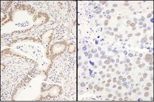 anti-Cell Division Cycle and Apoptosis Regulator 1 (CCAR1) (AA 1-50) antibody