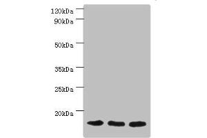 Western blot All lanes: Mitochondrial import receptor subunit TOM20 homolog antibody at 3 μg/mL Lane 1: Mouse brain tissue Lane 2: Hela whole cell lysate Lane 3: Mouse liver tissue Secondary Goat polyclonal to rabbit IgG at 1/10000 dilution Predicted band size: 16 kDa Observed band size: 16 kDa (TOMM2 (AA 20-145) Antikörper)