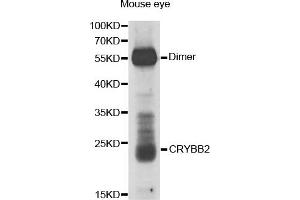 Western Blotting (WB) image for anti-Crystallin, beta B2 (CRYbB2) antibody (ABIN1876777)