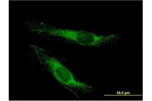 Immunofluorescence of monoclonal antibody to LSS on HeLa cell. (LSS Antikörper  (AA 633-732))