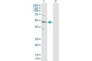 Western Blot analysis of KIR2DL4 expression in transfected 293T cell line by KIR2DL4 MaxPab polyclonal antibody. (KIR2DL4/CD158d Antikörper  (AA 1-377))