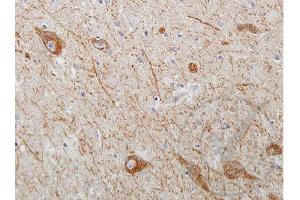 Immunohistochemistry (IHC) image for anti-Wingless-Type MMTV Integration Site Family Member 2 (WNT2) (AA 221-320) antibody (ABIN762896)