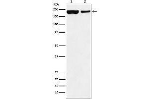 Western blot analysis of KDM5A / Jarid1A / RBBP2 expression in (1) HEK293 cell lysate, (2) Mouse spleen lysate.