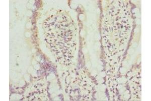 Immunohistochemistry of paraffin-embedded human small intestine tissue using ABIN7142022 at dilution of 1:100 (AGPAT2 Antikörper  (AA 199-278))