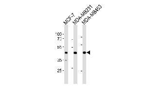 SGCG Antibody (Center) (ABIN1881799 and ABIN2843437) western blot analysis in MCF-7,MDA-M,MDA-M cell line lysates (35 μg/lane).