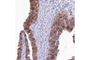 Immunohistochemical staining of human fallopian tube with LRRC34 polyclonal antibody  shows strong cytoplasmic and membrane positivity in glandular cells. (LRRC34 Antikörper)