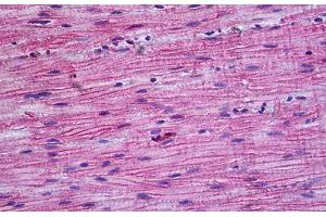 Immunohistochemistry (IHC) image for anti-Protein Phosphatase 3, Catalytic Subunit, alpha Isoform (PPP3CA) (AA 21-51) antibody (ABIN1804070)