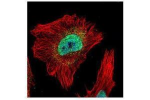 ICC/IF Image Confocal immunofluorescence analysis (Olympus FV10i) of paraformaldehyde-fixed HeLa, using Tankyrase 2, antibody (Green) at 1:500 dilution. (TNKS2 Antikörper  (N-Term))
