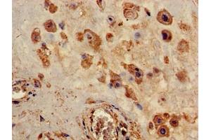 Immunohistochemistry of paraffin-embedded human placenta tissue using ABIN7162445 at dilution of 1:100 (P2RX4 Antikörper  (AA 91-176))