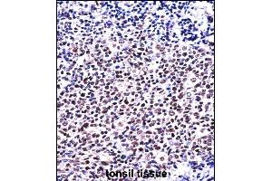 Immunohistochemistry (Paraffin-embedded Sections) (IHC (p)) image for anti-Nuclear Factor of Activated T-Cells, Cytoplasmic, Calcineurin-Dependent 1 (NFATC1) (AA 898-927), (C-Term) antibody (ABIN657821)