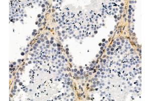 Phospho-Nanog (Thr280) Antibody at 1/100 staining Mouse testis tissue by IHC-P.