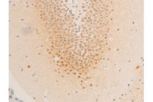 Immunohistochemistry (IHC) image for anti-Baculoviral IAP Repeat-Containing 5 (BIRC5) (pThr117) antibody (ABIN6255588)