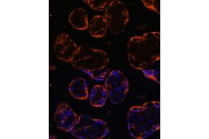 Immunofluorescence analysis of human placenta cells using PSG1 antibody (ABIN6132526, ABIN6146294, ABIN6146296 and ABIN6222029) at dilution of 1:100.