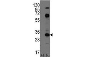 Western blot analysis of CD8 antibody and 293 cell lysate (2 ug/lane) either nontransfected (Lane 1) or transiently transfected with the CD8A gene (2). (CD8 alpha Antikörper  (AA 150-180))