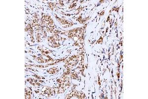 IHC analysis of Symplekin/SYMPK using anti-Symplekin/SYMPK antibody (ABIN7601558). (Symplekin Antikörper  (AA 384-1092))
