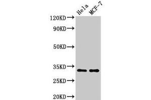 Western Blot Positive WB detected in: Hela whole cell lysate, MCF-7 whole cell lysate All lanes: HIST1H1B antibody at 1. (Histone H1.5 Antikörper  (pThr154))
