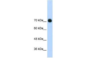 WB Suggested Anti-GTF2IRD1 Antibody Titration:  2. (GTF2IRD1 Antikörper  (C-Term))