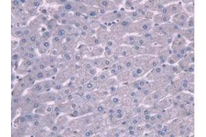 IHC-P analysis of Human Liver Tissue, with DAB staining. (PLG Antikörper  (AA 274-560))