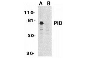 Western blot analysis of PID expression in HeLa whole cell lysates in the absence (A) or presence (B) of blocking peptide with PID antibody at 1 ug /ml.
