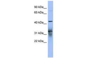 Image no. 1 for anti-Poly(A) Binding Protein, Cytoplasmic 5 (PABPC5) (AA 71-120) antibody (ABIN6743042) (PABPC5 Antikörper  (AA 71-120))