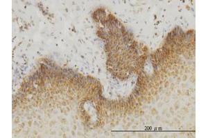 Image no. 3 for anti-Insulin Receptor-Related Receptor (INSRR) (AA 651-760) antibody (ABIN598764) (INSRR Antikörper  (AA 651-760))