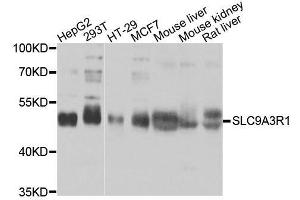 Western blot analysis of extracts of various cell lines, using SLC9A3R1 antibody. (SLC9A3R1 Antikörper  (AA 189-358))