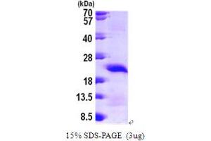 SDS-PAGE (SDS) image for Calcium Regulated Heat Stable Protein 1, 24kDa (CARHSP1) (AA 1-147) protein (His tag) (ABIN667824) (CARHSP1 Protein (AA 1-147) (His tag))