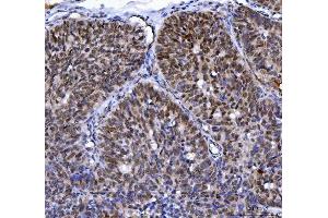 IHC analysis of MLH1 using anti-MLH1 antibody (ABIN7599691). (MLH1 Antikörper  (AA 108-756))