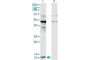 Western Blot analysis of CCL2 expression in transfected 293T cell line by CCL2 monoclonal antibody (M07), clone 2E10. (CCL2 Antikörper  (AA 1-99))