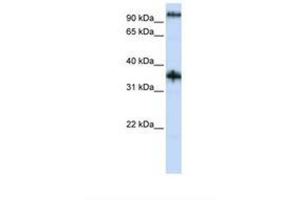 Ferric-Chelate Reductase 1 Like (FRRS1L) (AA 74-123) Antikörper