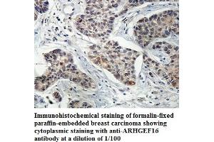 Image no. 1 for anti-rho Guanine Nucleotide Exchange Factor (GEF) 16 (ARHGEF16) antibody (ABIN1574807)