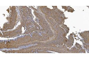 IHC analysis of PLTP using anti-PLTP antibody (ABIN7600346). (PLTP Antikörper  (AA 18-470))