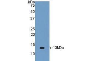 WB of Protein Standard: different control antibodies against Highly purified E. (beta-2 Microglobulin CLIA Kit)