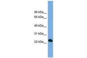 Image no. 1 for anti-B-Cell CLL/lymphoma 7A (BCL7A) (AA 71-120) antibody (ABIN6743279) (BCL7A Antikörper  (AA 71-120))