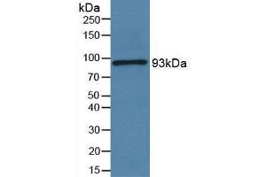 Detection of POSTN in Human Serum using Polyclonal Antibody to Periostin (POSTN) (Periostin Antikörper  (AA 97-230))