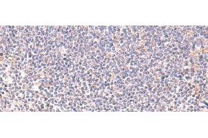 Immunohistochemistry of paraffin-embedded Human tonsil tissue using DHPS Polyclonal Antibody at dilution of 1:75(x200) (DHPS Antikörper)