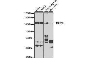 Western blot analysis of extracts of various cell lines, using TNNI3K antibody (ABIN6132847, ABIN6149361, ABIN6149362 and ABIN6223764) at 1:1000 dilution. (TNNI3K Antikörper  (AA 1-75))