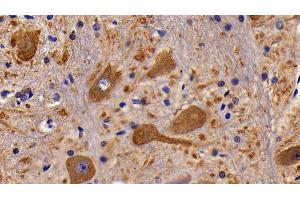 Detection of CHRM1 in Rat Spinal cord Tissue using Polyclonal Antibody to Cholinergic Receptor, Muscarinic 1 (CHRM1) (CHRM1 Antikörper  (AA 210-363))