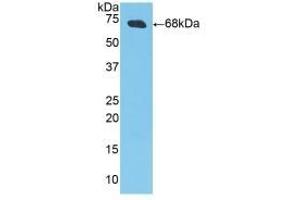 Detection of Recombinant CKM, Porcine using Polyclonal Antibody to Creatine Kinase, Muscle (CKM)