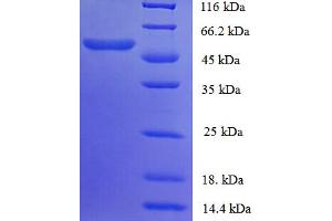 SDS-PAGE (SDS) image for Smg-7 Homolog, Nonsense Mediated mRNA Decay Factor (SMG7) (AA 19-550), (partial) protein (ABIN5710916)