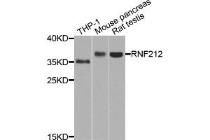 Western blot analysis of extracts of various cell lines, using RNF212 antibody (ABIN5971848) at 1/1000 dilution. (RNF212 Antikörper)